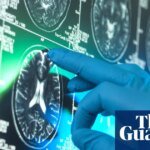 Alzheimer’s research is latest casualty in Trump administration war against ‘DEI’ | Trump administration