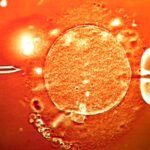 How doctors retrieve sperms from infertile men, help them become fathers