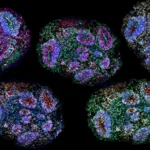 High Court to Weigh Stem Cell Frontier in Controversial Autism Treatment Battle