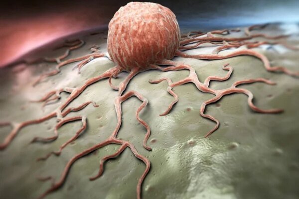 Inside the Chaos: How Turbulent Microenvironments Ignite Cancer’s Spread