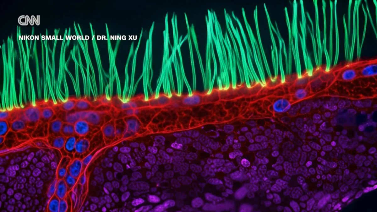 Microscopic Masterpiece or Digital Mirage? Prize-Winning Video Unmasked as AI Fabrication