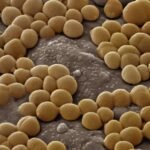 Silent Invader: How MRSA Hijacks the Kidney to Fuel Persistent Infection