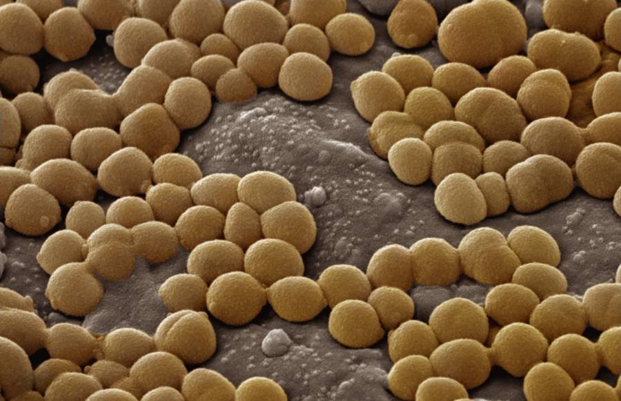 Silent Invader: How MRSA Hijacks the Kidney to Fuel Persistent Infection