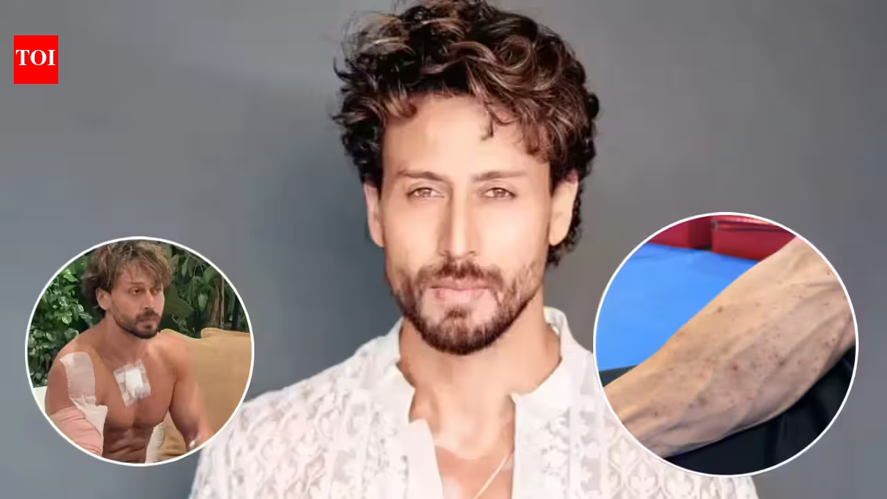 Tiger Shroff Narrowly Escapes Injury: Actor Reveals Shocking Gunpowder Burns After Stunt Goes Wrong